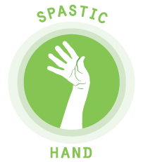 Spastic-Hand